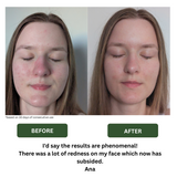 Instant Glow Face Serum