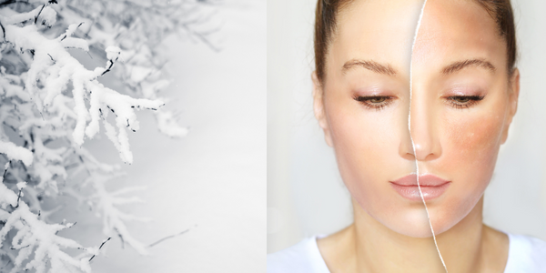 Tips that will help your skin survive the winter